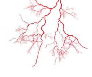 ヒートショック対策としておすすめのリフォーム